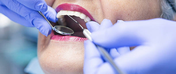 Best Dentist for Tooth Abscess  in Yacolt, WA